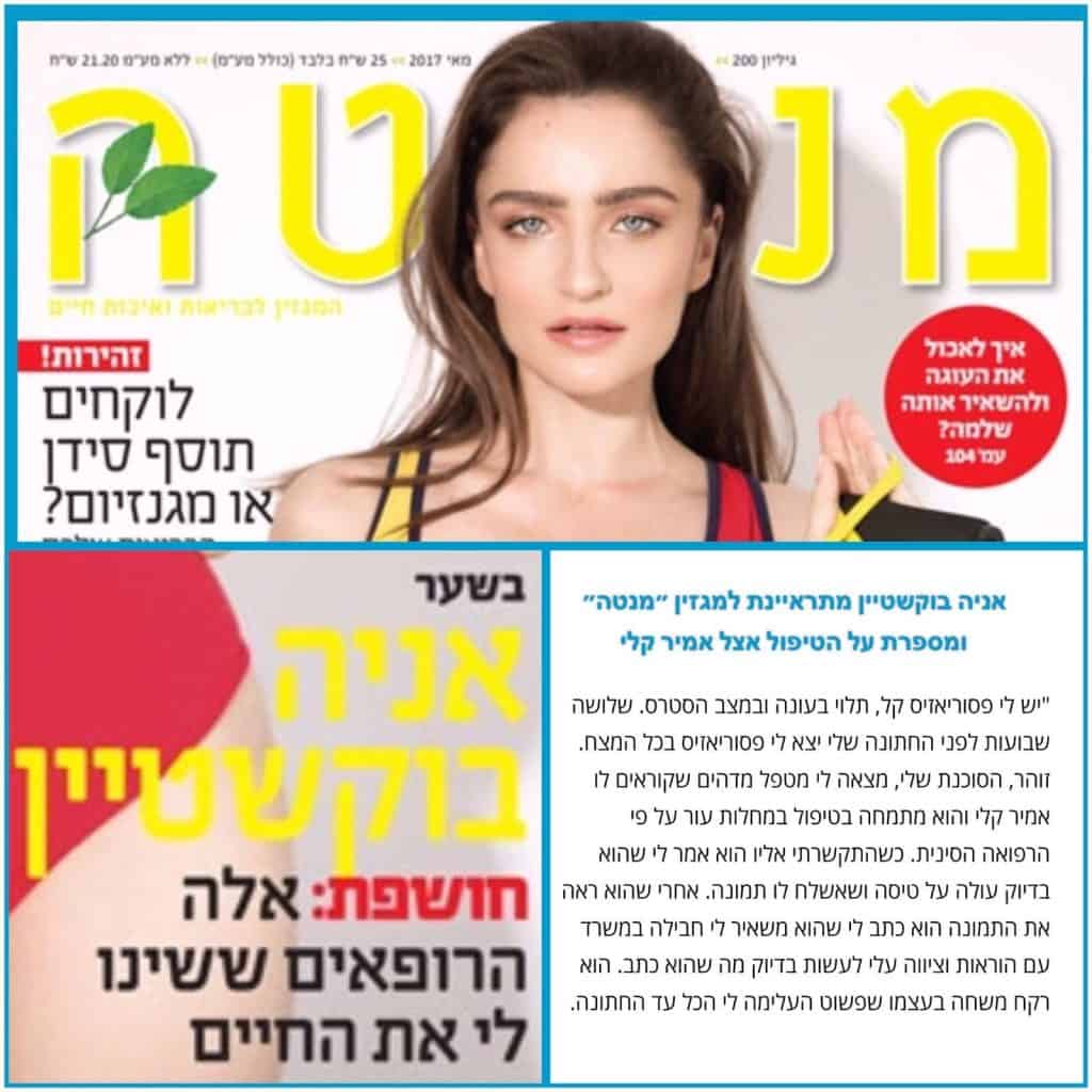 כתבה במגזין מנטה: אניה בוקשטיין מספרת על הטיפול בפסוריאזיס אצל אמיר קלי