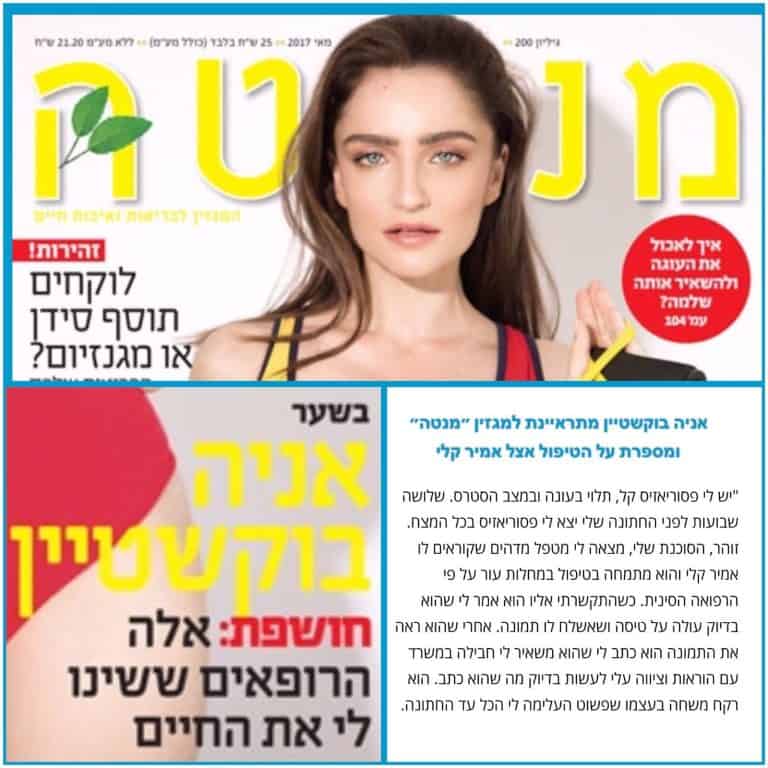 כתבה במגזין מנטה: אניה בוקשטיין מספרת על הטיפול בפסוריאזיס אצל אמיר קלי